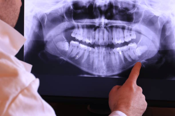 Best Pediatric Emergency Dentist in Colesville, MD