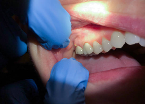 Best Pediatric Emergency Dentist in Colesville, MD