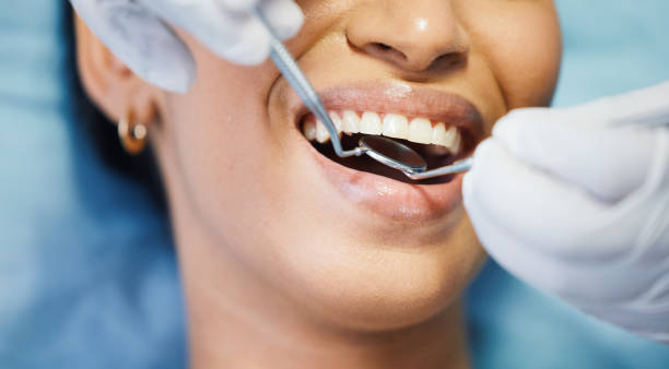 Best Emergency Wisdom Teeth Removal in Colesville, MD
