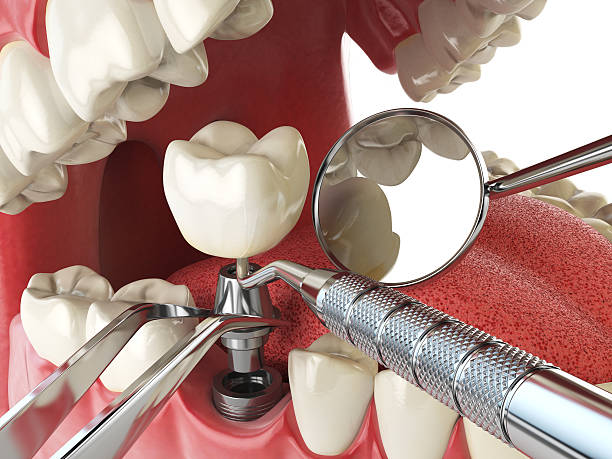 Best Walk-In Emergency Dentist in Colesville, MD